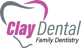 Clay Dentals